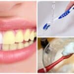 Cinco formas naturales y efectivas para aclarar tus dientes en casa