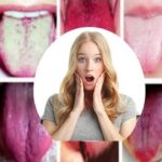 7 Problemas De Salud Que Puedes Detectar Con Solo Mirar Tu Lengua