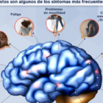 Desorden En El Sistema Inmunologico Que Solo Ataca El Cerebro De Las Mujeres Conoce Sus Sintomas